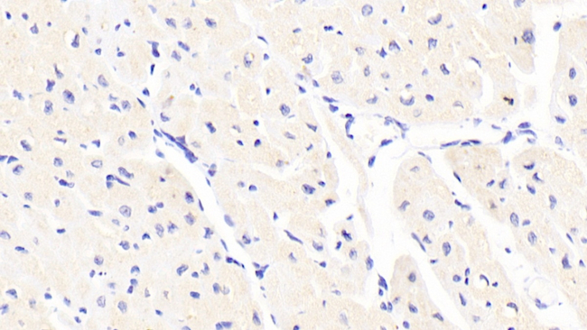 FLRT2 Antibody in Immunohistochemistry (Paraffin) (IHC (P))