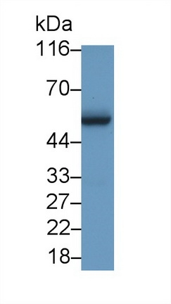 c-Myc Antibody in Western Blot (WB)