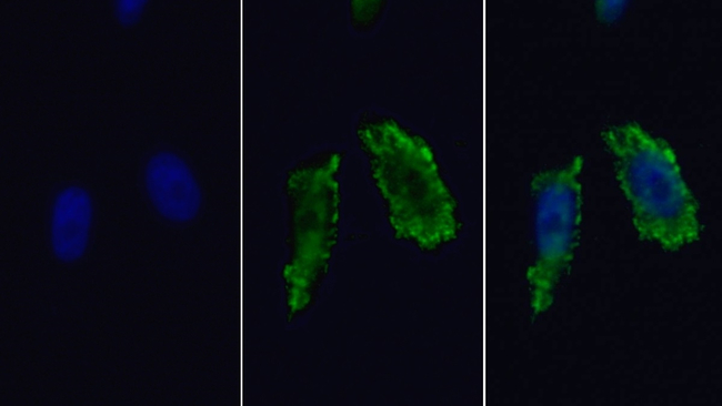 HK2 Antibody in Immunocytochemistry (ICC/IF)