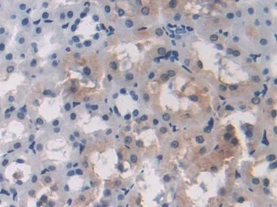 OAS1 Antibody in Immunohistochemistry (Paraffin) (IHC (P))