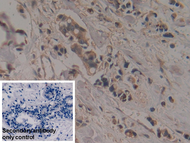 Creatine Kinase MT Antibody in Immunohistochemistry (Paraffin) (IHC (P))