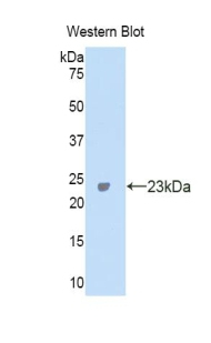 Carbonic Anhydrase VA Antibody in Western Blot (WB)