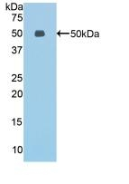 Endocan Antibody in Western Blot (WB)