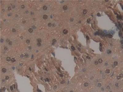 TNP1 Antibody in Immunohistochemistry (Paraffin) (IHC (P))