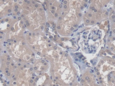 CBY1 Antibody in Immunohistochemistry (Paraffin) (IHC (P))