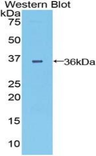 DISP1 Antibody in Western Blot (WB)