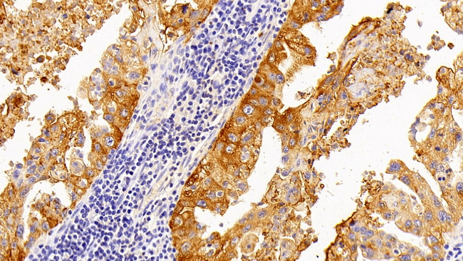 SFTPA2 Antibody in Immunohistochemistry (Paraffin) (IHC (P))