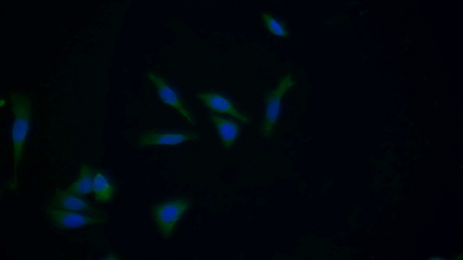 GSTM1 Antibody in Immunocytochemistry (ICC/IF)