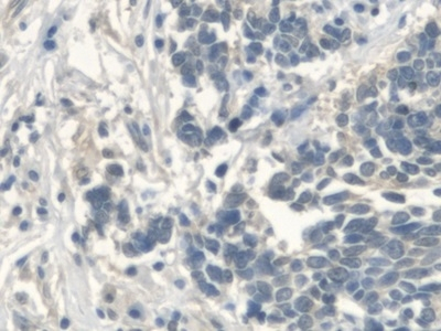 UGCG Antibody in Immunohistochemistry (Paraffin) (IHC (P))