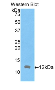 ARPC4 Antibody in Western Blot (WB)