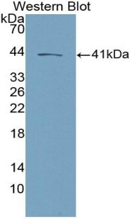 NKB Antibody in Western Blot (WB)