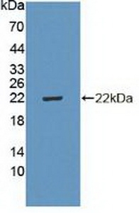 p19 INK4d Antibody in Western Blot (WB)