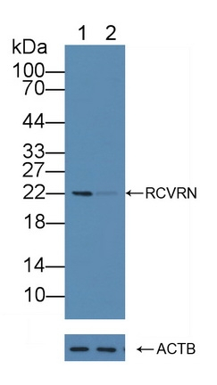 Recoverin Antibody in Western Blot (WB)