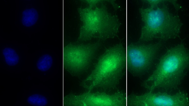 TMSB4X Antibody in Immunocytochemistry (ICC/IF)