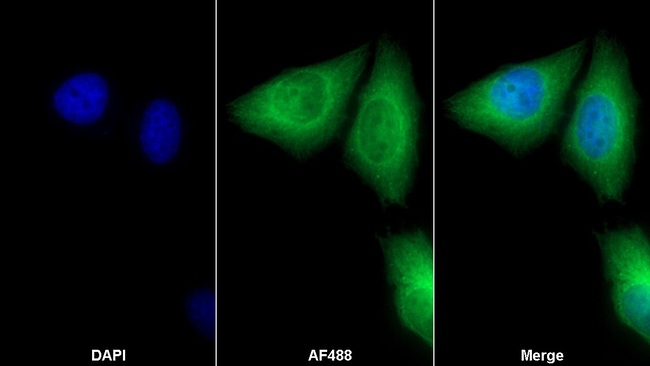 GARS Antibody in Immunocytochemistry (ICC/IF)