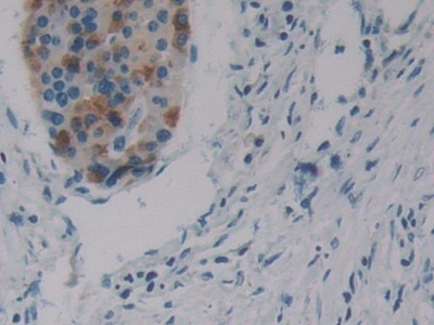 SRF Antibody in Immunohistochemistry (Paraffin) (IHC (P))