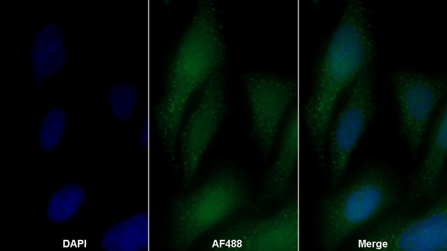 Arginase 1 Antibody in Immunocytochemistry (ICC/IF)