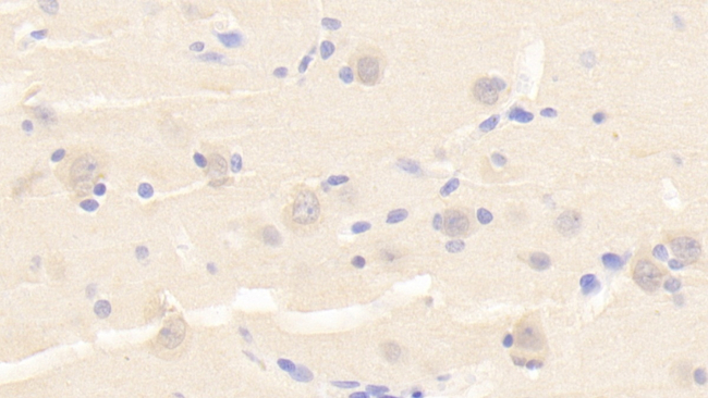 PTPRS Antibody in Immunohistochemistry (Paraffin) (IHC (P))