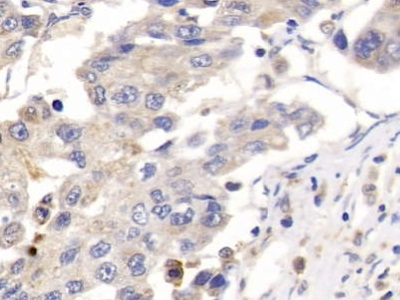 Placental lactogen Antibody in Immunohistochemistry (Paraffin) (IHC (P))