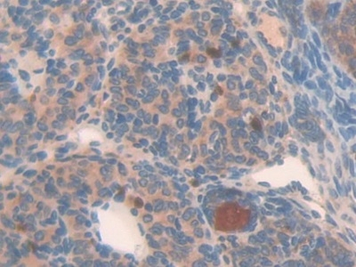 NAIP Antibody in Immunohistochemistry (Paraffin) (IHC (P))