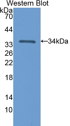 NT5C3A Antibody in Western Blot (WB)