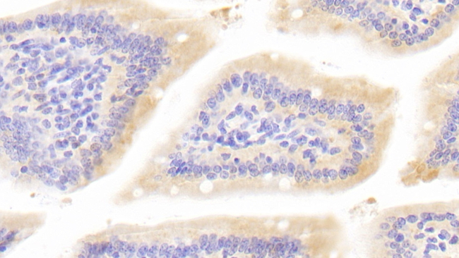 BMP1 Antibody in Immunohistochemistry (Paraffin) (IHC (P))