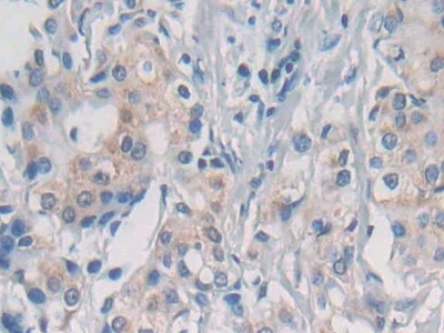 Nesprin 1 Antibody in Immunohistochemistry (Paraffin) (IHC (P))