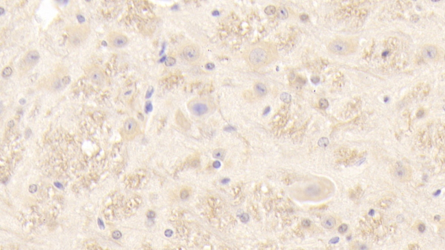 PMP22 Antibody in Immunohistochemistry (Paraffin) (IHC (P))