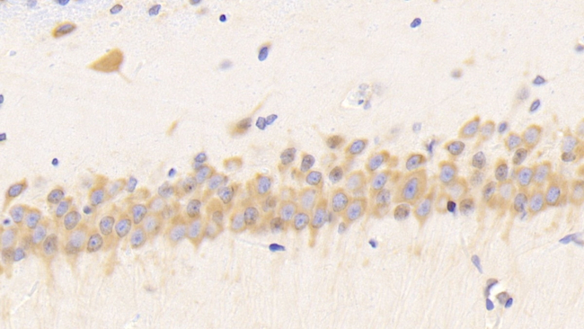 Resistin Antibody in Immunohistochemistry (Paraffin) (IHC (P))