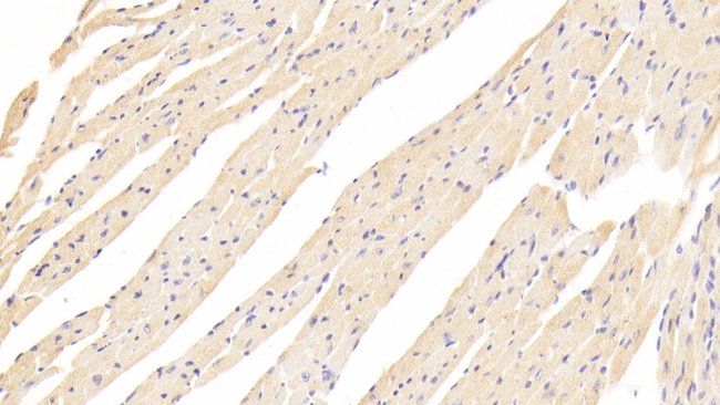 NISCH Antibody in Immunohistochemistry (Paraffin) (IHC (P))