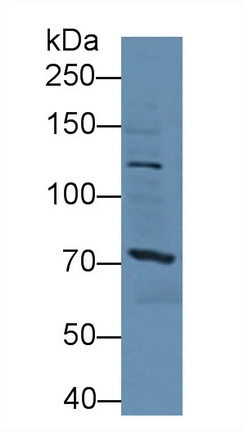 SSFA2 Antibody in Western Blot (WB)