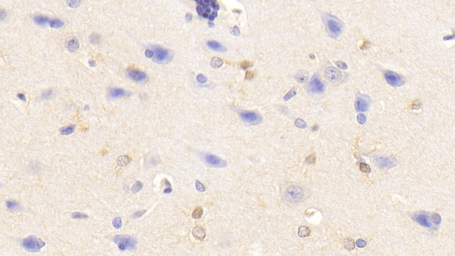 TNF alpha Antibody in Immunohistochemistry (Paraffin) (IHC (P))