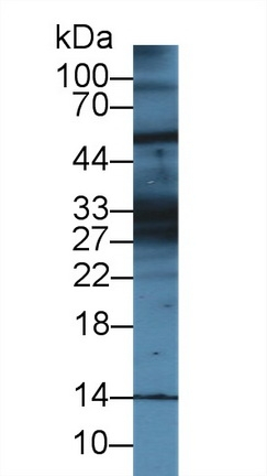 KRT28 Antibody in Western Blot (WB)