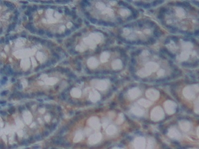 IL1F5 Antibody in Immunohistochemistry (Paraffin) (IHC (P))