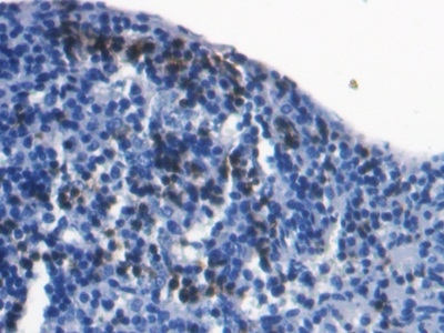 S100A8 Antibody in Immunohistochemistry (Paraffin) (IHC (P))
