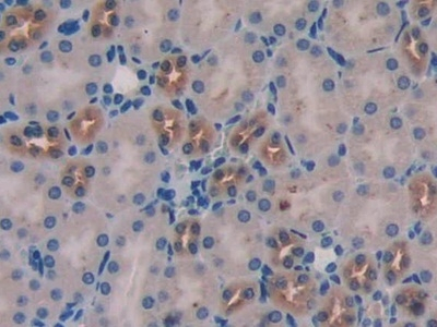WISP1 Antibody in Immunohistochemistry (Paraffin) (IHC (P))