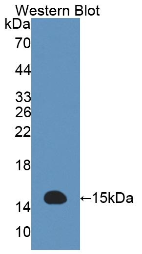 ACYP2 Antibody in Western Blot (WB)