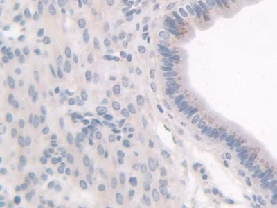 HPS1 Antibody in Immunohistochemistry (Paraffin) (IHC (P))
