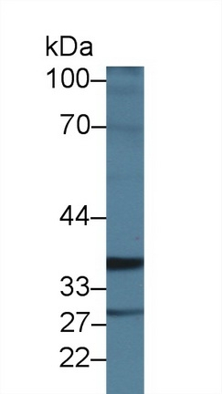 ICK Antibody in Western Blot (WB)