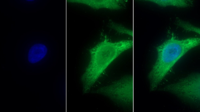 MTNR1A Antibody in Immunocytochemistry (ICC/IF)