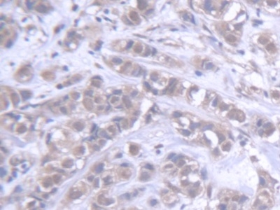ABCB6 Antibody in Immunohistochemistry (Paraffin) (IHC (P))