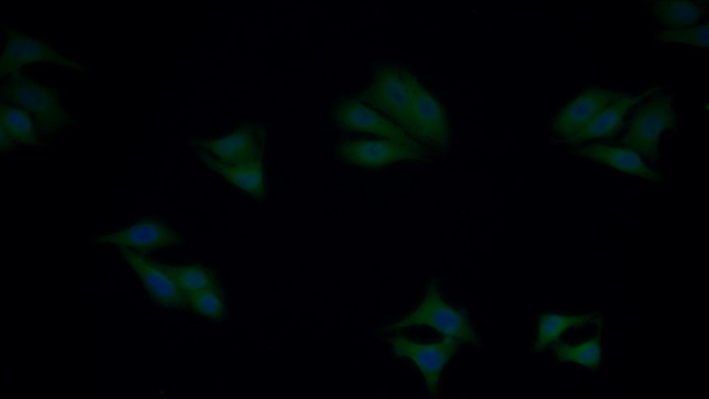 gamma Actin Antibody in Immunocytochemistry (ICC/IF)