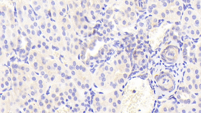 CXCL11 Antibody in Immunohistochemistry (Paraffin) (IHC (P))