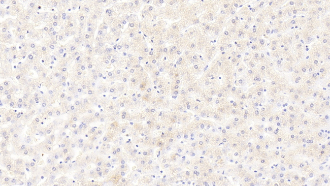 Calmodulin Antibody in Immunohistochemistry (Paraffin) (IHC (P))