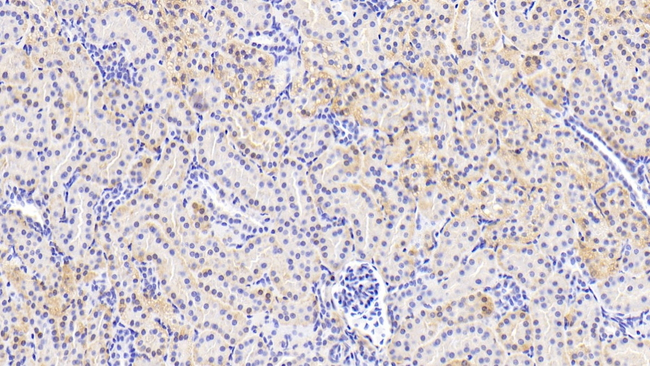 OSTM1 Antibody in Immunohistochemistry (Paraffin) (IHC (P))