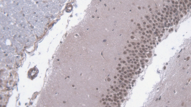 FMO2 Antibody in Immunohistochemistry (Paraffin) (IHC (P))