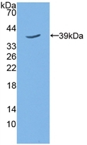 5T4 Antibody in Western Blot (WB)