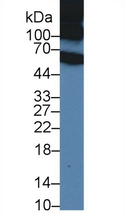 ITIH1 Antibody in Western Blot (WB)