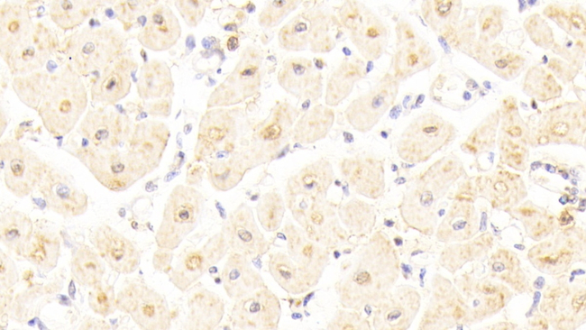 PGM5 Antibody in Immunohistochemistry (Paraffin) (IHC (P))