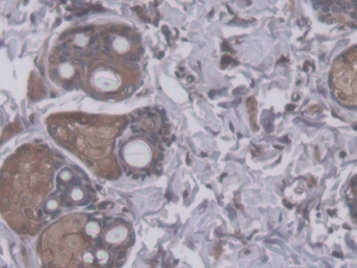 RHAG Antibody in Immunohistochemistry (Paraffin) (IHC (P))